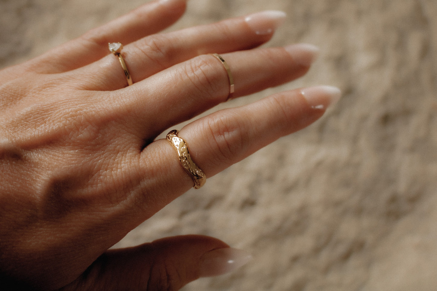 lorna ring